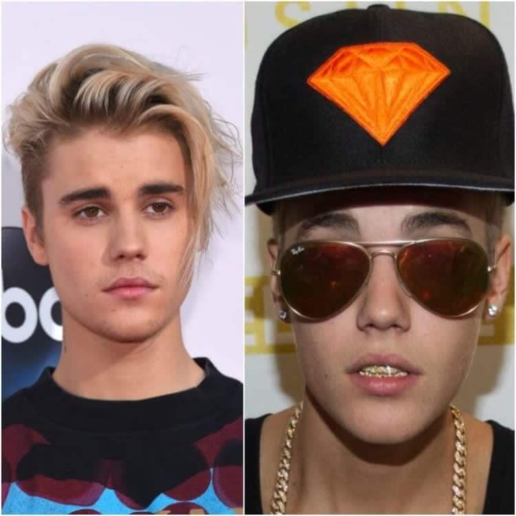 Justin Bieber: Custom-Made Gold Grillz